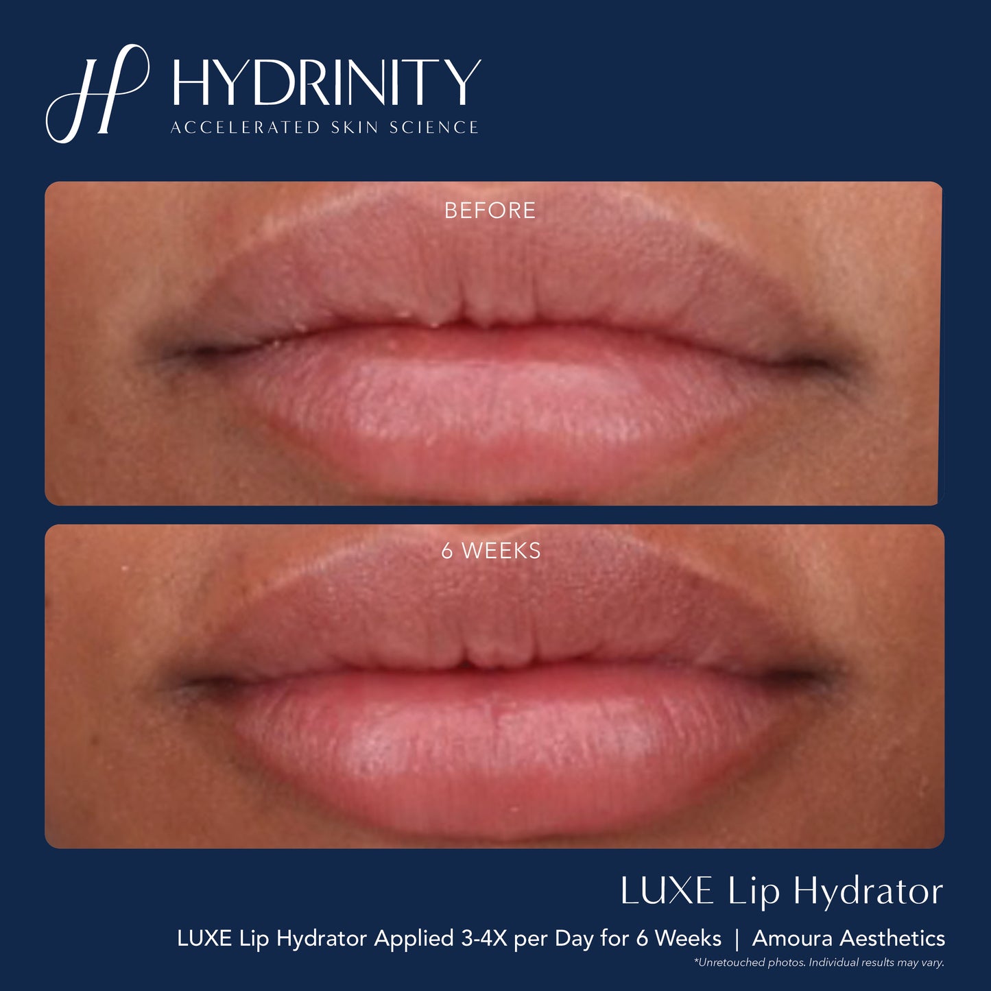 Lip Luxe