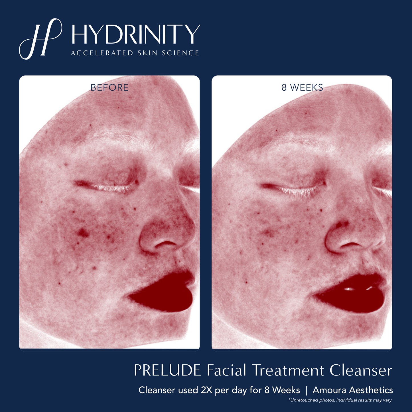 Prelude Facial Treatment Cleanser