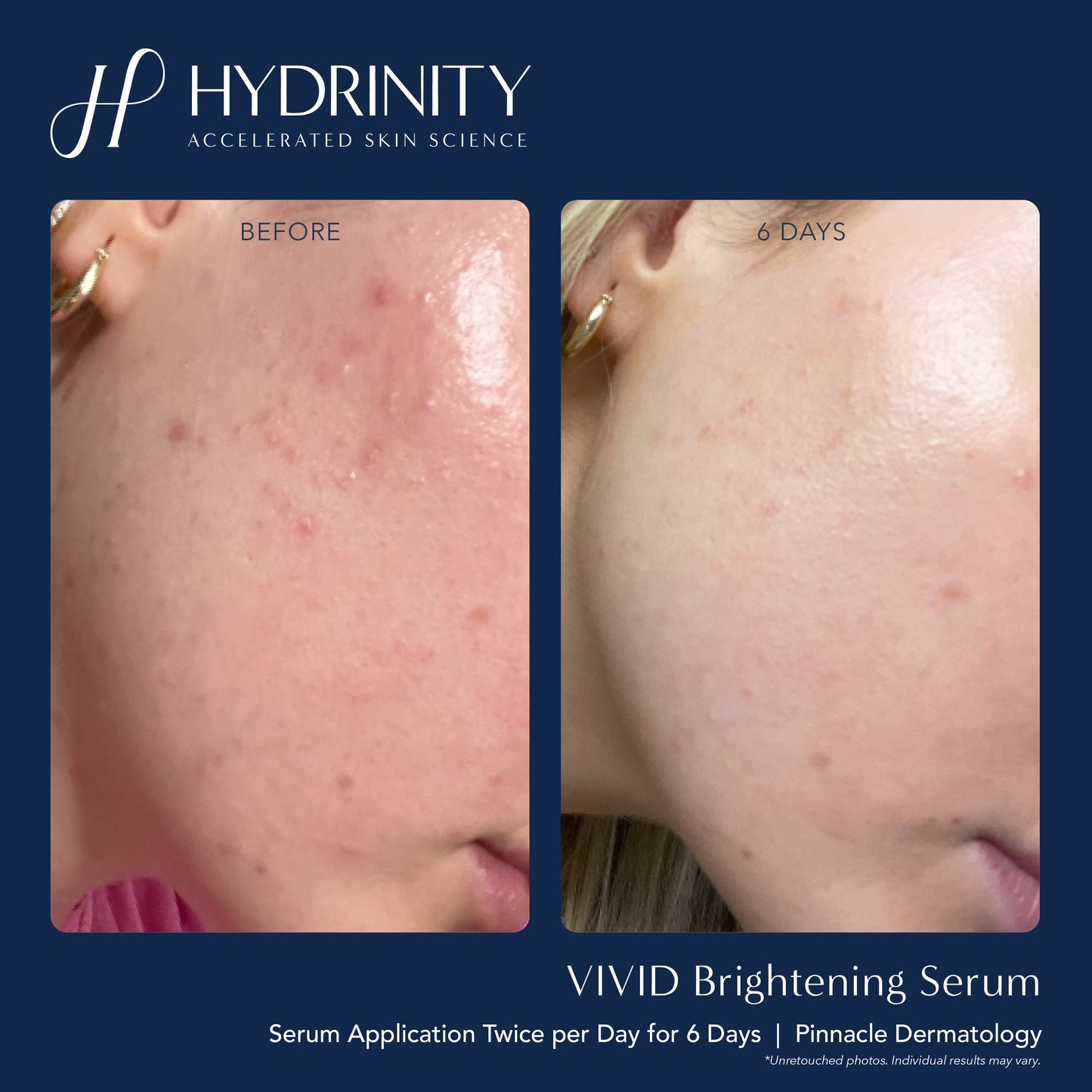 Vivid Brightening Serum