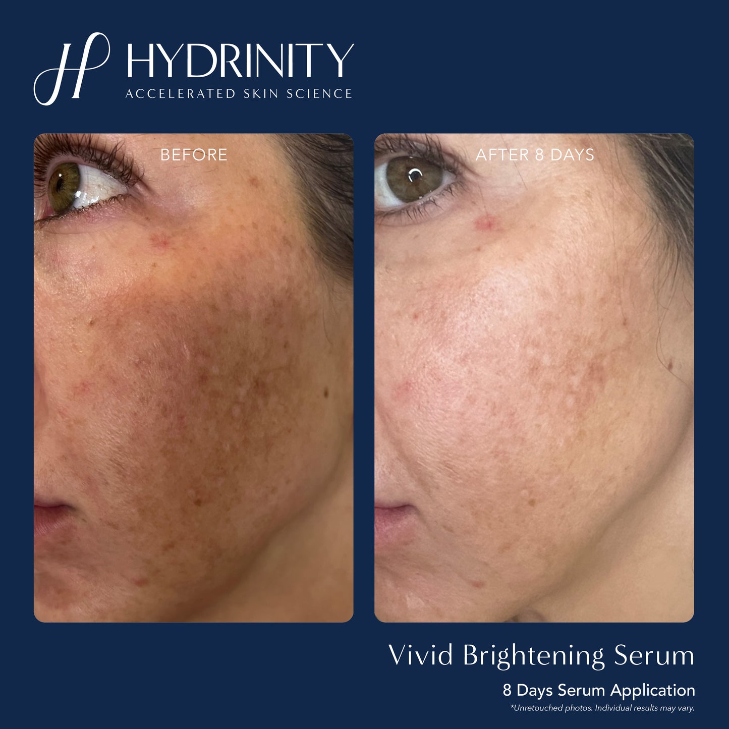 Vivid Brightening Serum