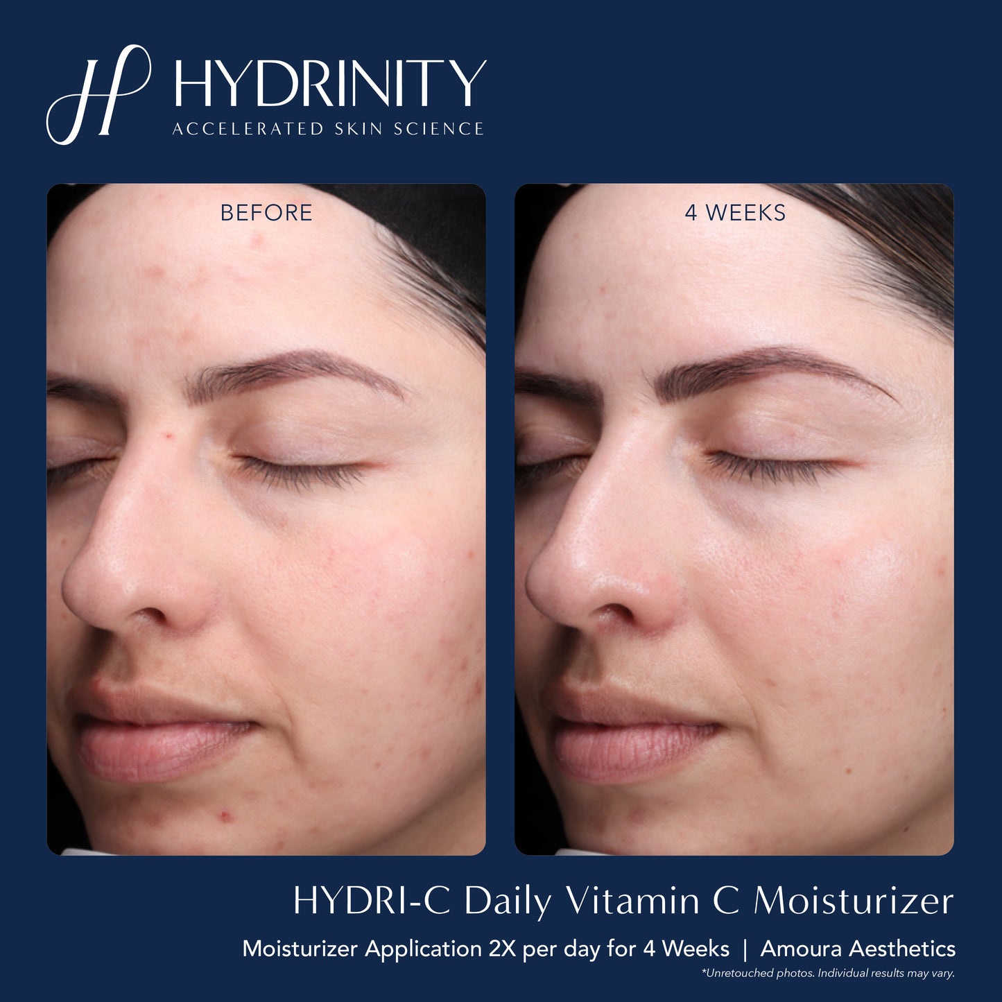Hydri-C Daily Moisturizer