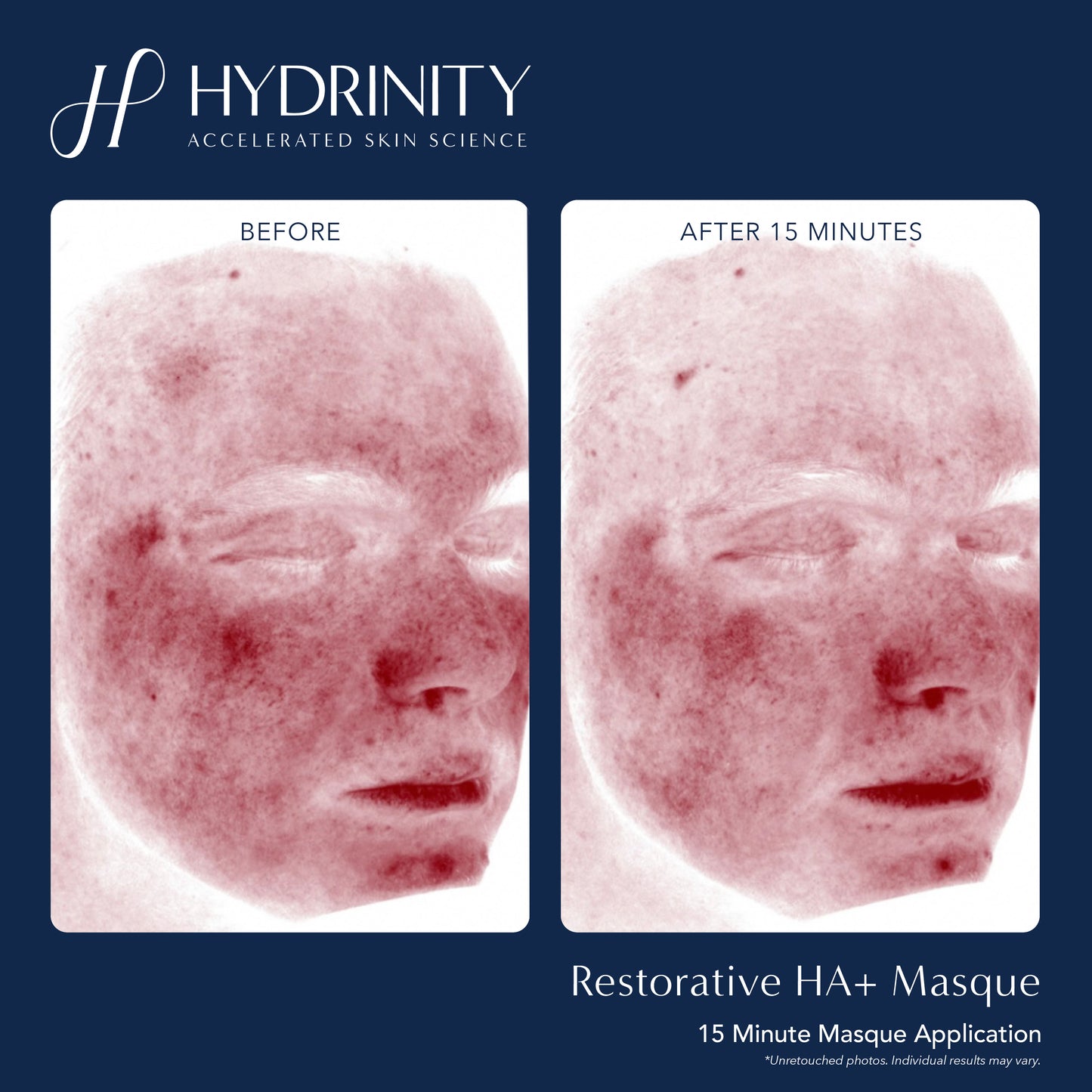 Restorative HA+ Masque