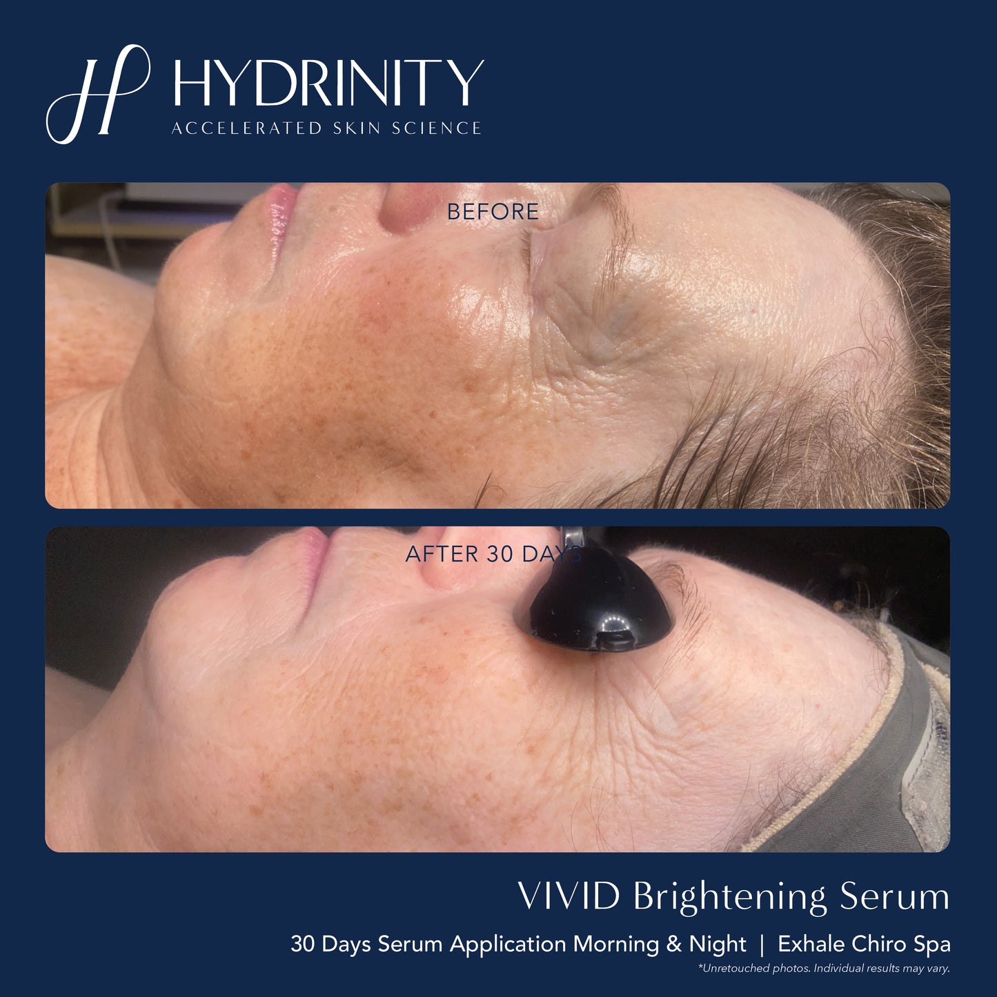 Vivid Brightening Serum