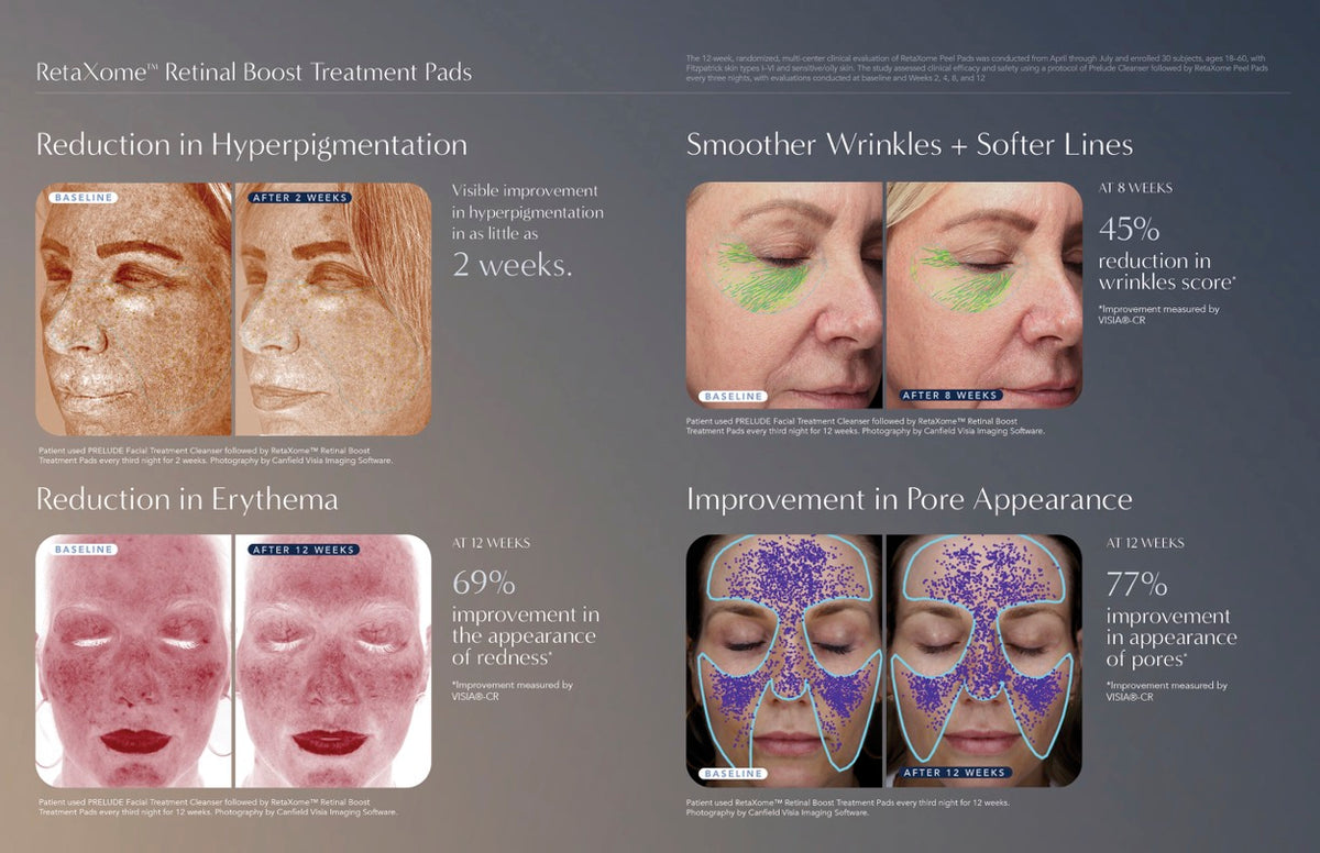 RetaXome Retinal Boost Treatment Pads